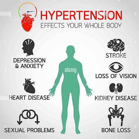 hypertension-ef