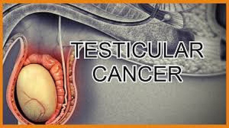 testicular_cancer