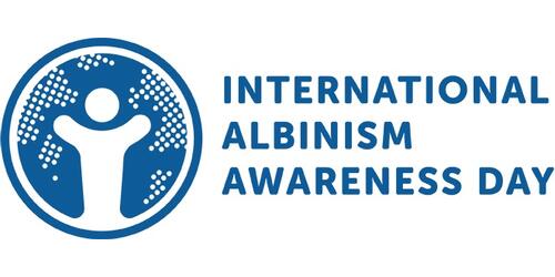 International Albinism Awareness Day 2023