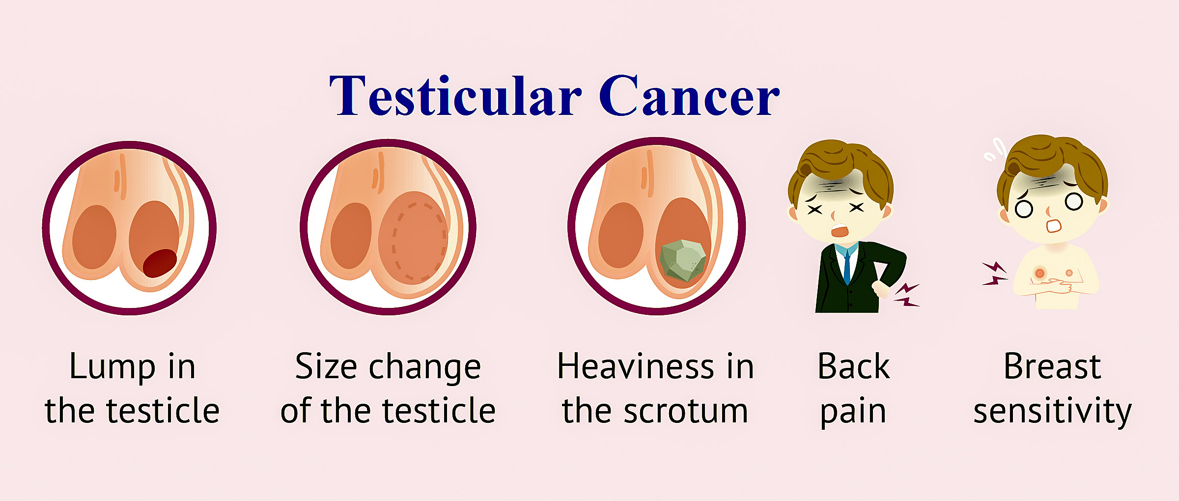 What Is Testicular Cancer Its Symptoms Causes Diagnosis And Treatment
